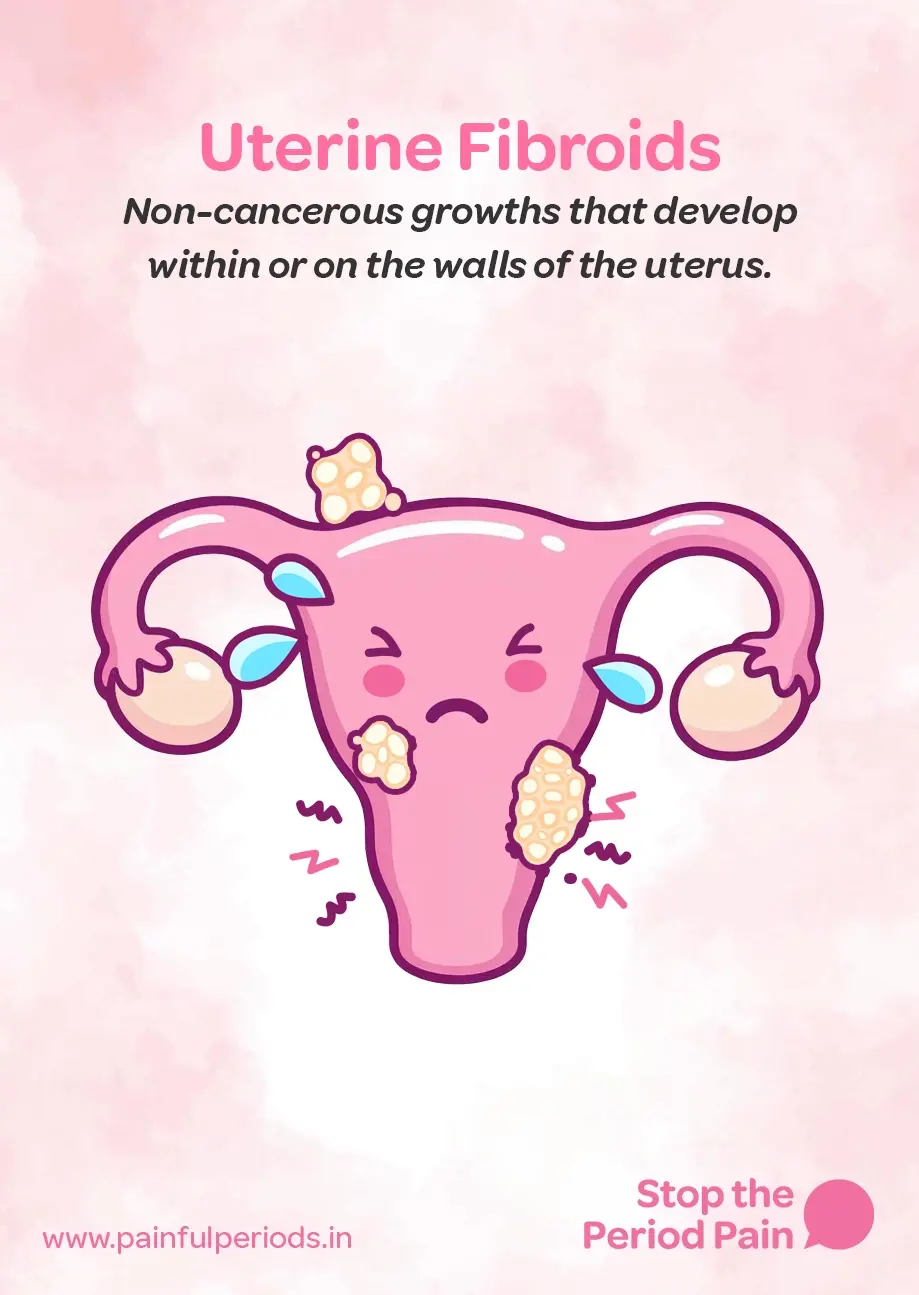 An illustrated educational graphic about uterine fibroids, a common cause of painful periods. The background is pink with a soft watercolor texture. At the top, bold pink text reads "Uterine Fibroids", followed by black italic text saying, "Non-cancerous growths in the uterus that develop within or on the uterine walls." Below the text is a cartoon-style illustration of a uterus with a sad face, eyes shut tight, and tears coming from both eyes, indicating severe menstrual cramps and pelvic pain. The uterus is depicted in pink with fallopian tubes and ovaries on each side. Multiple yellowish, bumpy fibroid tumors in uterus are shown growing on various parts of the uterus, including inside and on its outer wall. Zigzag lines around the uterus represent period pain and discomfort. In the bottom right corner, pink text says, "Stop the Period Pain" next to a speech bubble icon. In the bottom left corner, the website "www.painfulperiods.in" is displayed, suggesting a resource for information on uterine fibroids treatment and relief from painful menstruation. The graphic portrays the campaign message "STOP The Period Pain." Which is a knowledge initiative campaign by Blue Cross Laboratories the makers of meftal spas.