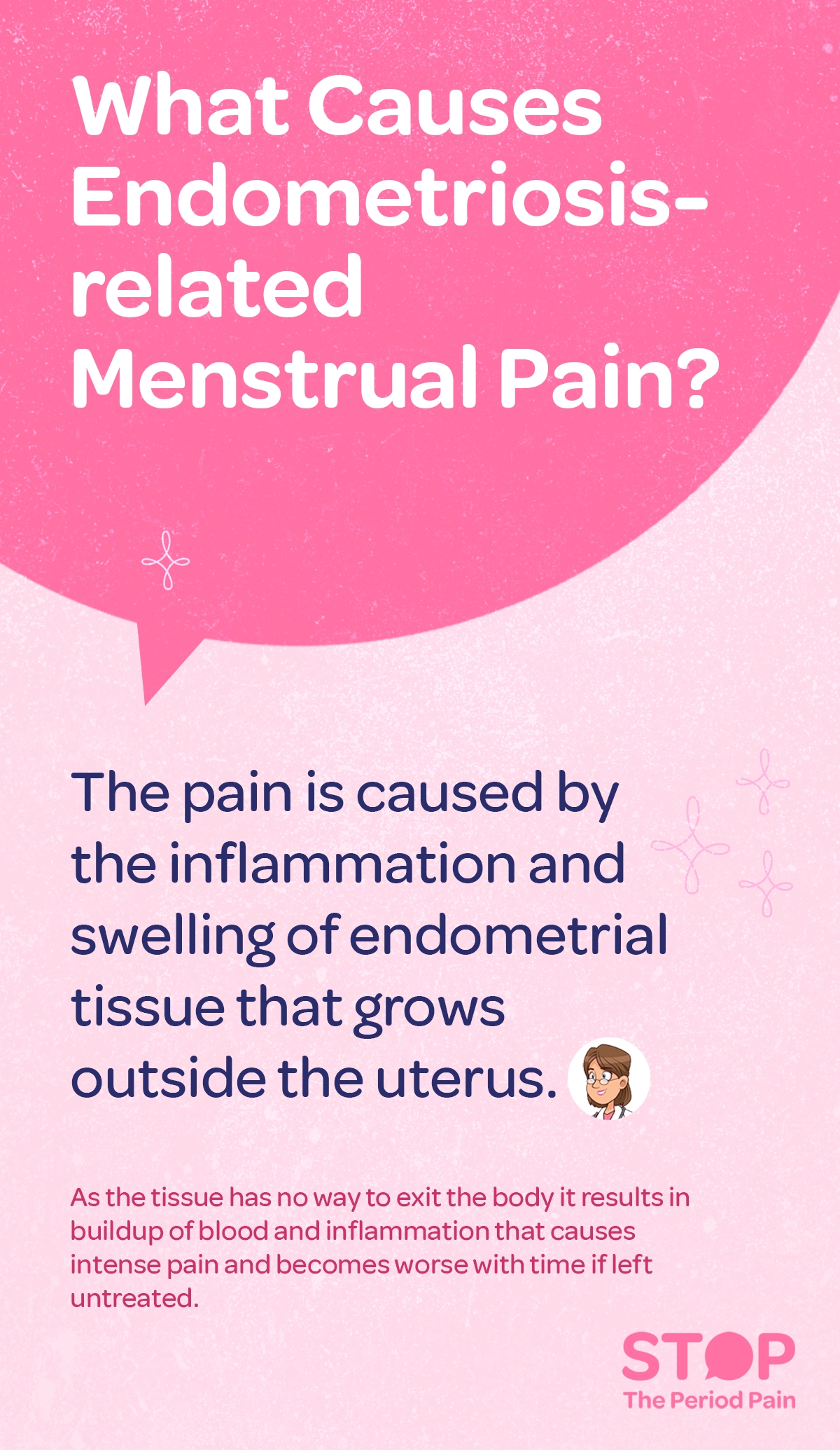 A pink and light purple infographic with the following text: "What Causes Endometriosis-related Menstrual Pain?" The text explains that the pain is caused by inflammation and swelling of endometrial tissue growing outside the uterus. It further elaborates that because the tissue has no way to exit the body, it leads to a buildup of blood and inflammation, causing intense period pain that worsens over time if left untreated. The graphic includes a friendly illustration of a doctor with glasses and a stethoscope, and a logo at the bottom that says "STOP The Period Pain." The background is a soft pink with light abstract star shapes surrounding the content. The graphic ends in the bottom right corner with the campaign message "STOP The Period Pain." Which is a knowledge initiative campaign by Blue Cross Laboratories the makers of meftal spas.