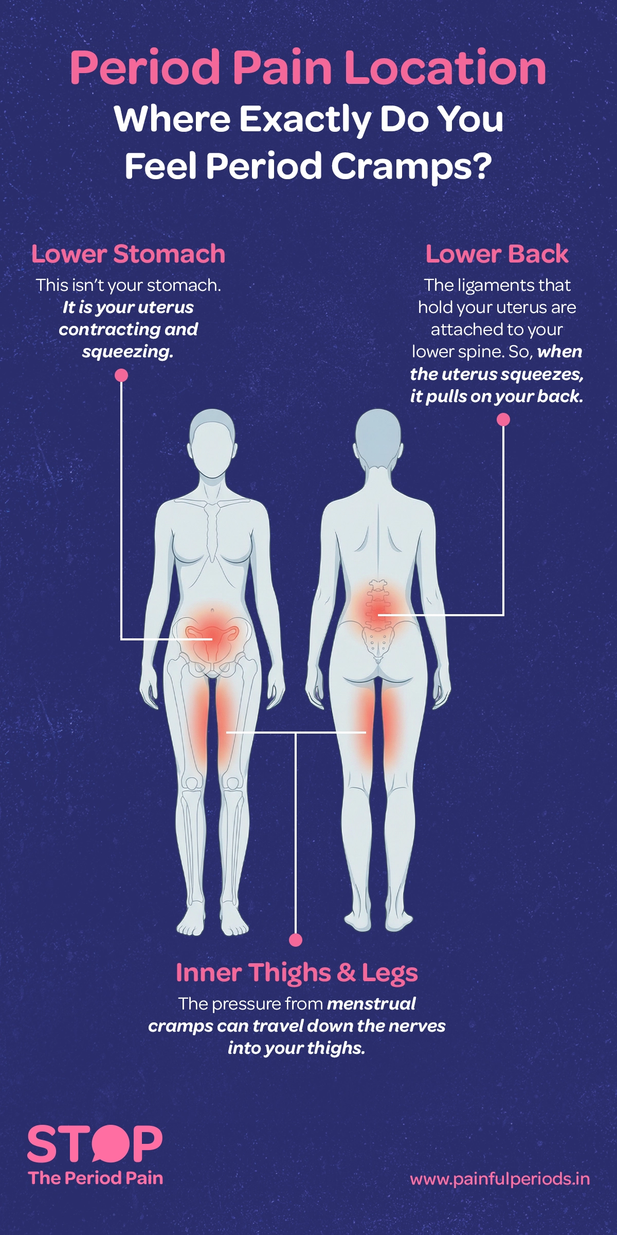 A diagram showing period pain location and explaining what causes painful period pain and reasons for bad period pain.